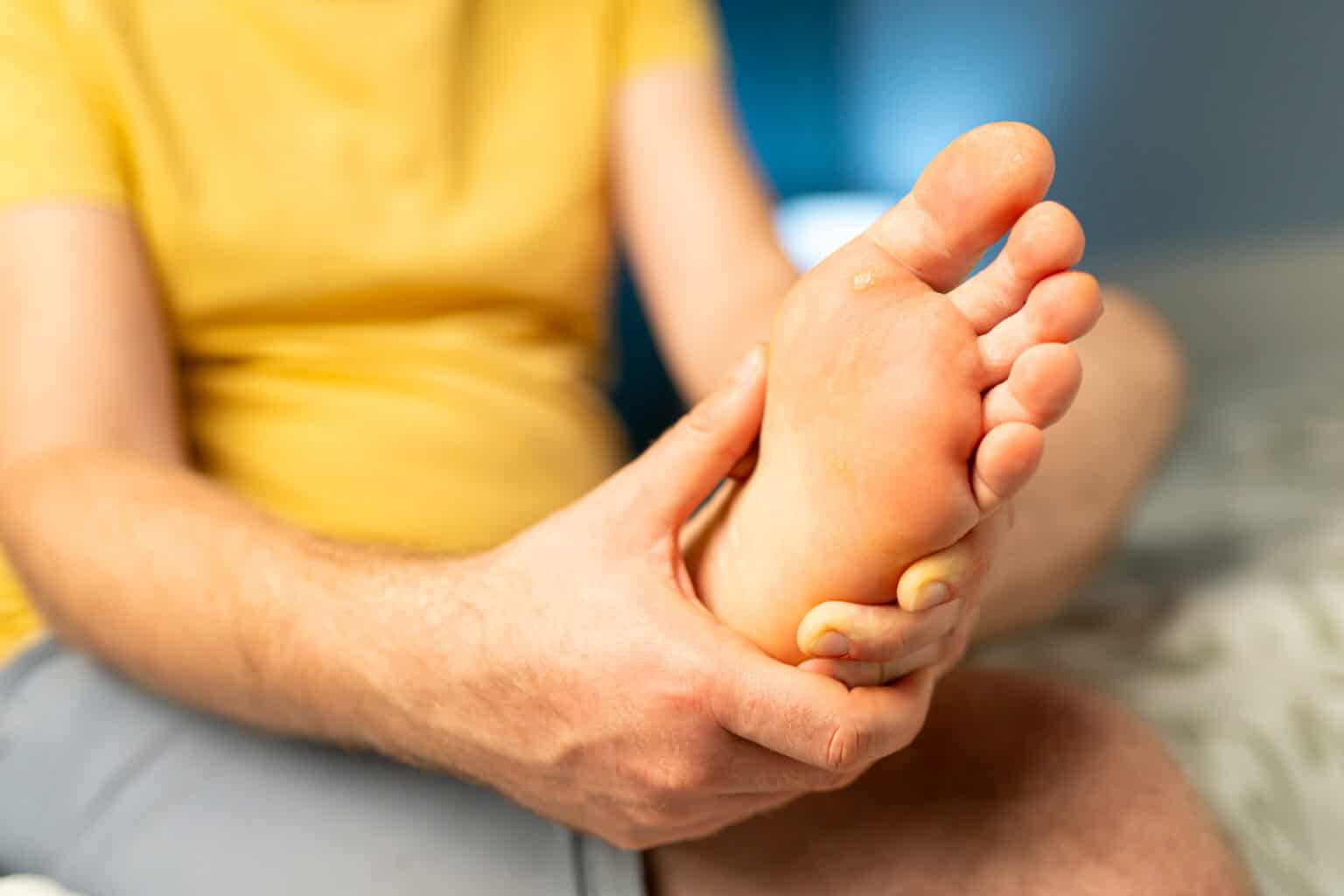 Plantar Warts
